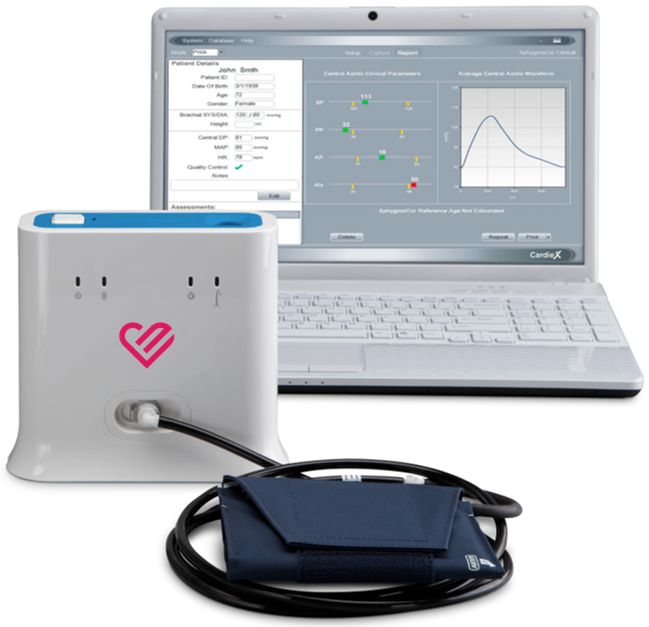 SphygmoCor technology image