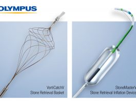 ERCP Stone Management Devices