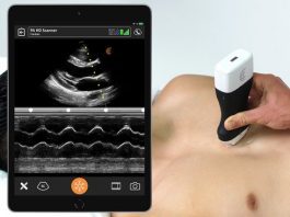 Clarius PA HD is now available for high resolution cardiac imaging with the release of the Clarius Ultrasound App 7.3.0