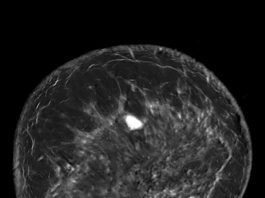 QT Imaging, Selects Freedom Ventures B.V., As the Exclusive Distributor of Its 3D Breast Imaging Technology in the EMEA Markets