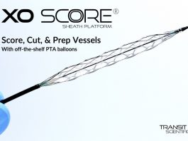 Transit Scientific, XO Score