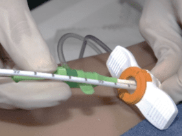 MEDCERT, Single Access Procedure with Impella CP