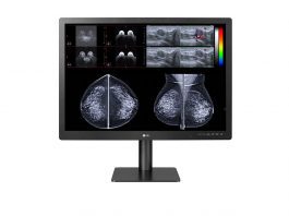 LG, Expands Diagnostic Medical Monitor Line with New 12-Megapixel Multimodality Display