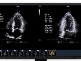 Circle Cardiovascular Imaging Inc. and DiA Imaging Analysis Partnership