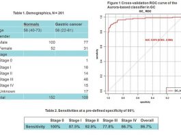 AnchorDx’s Non-invasive Bladder Cancer Early Detection Test