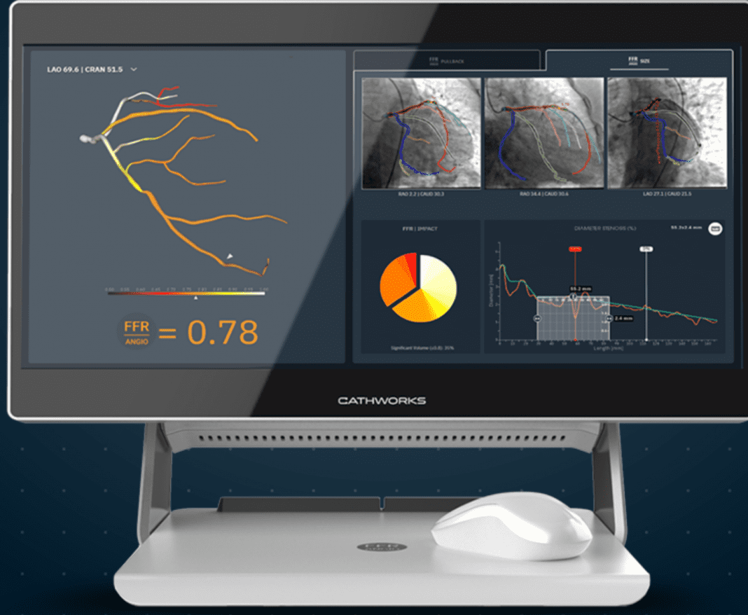 CathWorks FFRangio™ System, Receives National Reimbursement Approval in Japan