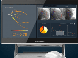 CathWorks FFRangio™ System, Receives National Reimbursement Approval in Japan