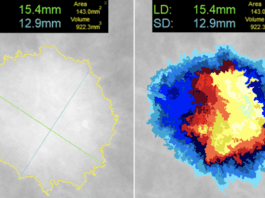 FDA Clears DL Precise One-Click Segmentation & Measurement Tool Delivers Consistent Precision in All Medical Imaging Modalities