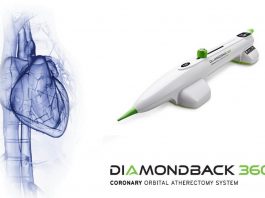 First Patients in Canada Treated With Cardiovascular Systems, Inc. Diamondback 360® Coronary Orbital Atherectomy System