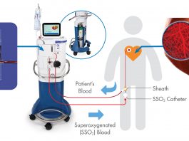 New Category III CPT Code for TherOx SSO2 Therapy (ZOLL Medical)