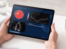 Ultromics Raises $33M Series B Funding Led by Blue Venture Fund