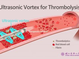 NTHU Researchers Develop Ultrasonic Vortex Thrombolytic Device