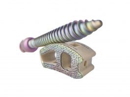 Nanovis Announces Alpha Launch of the First and Only Bioceramic Nanotube-Enhanced Pedicle Screw System, Nano FortiFix®