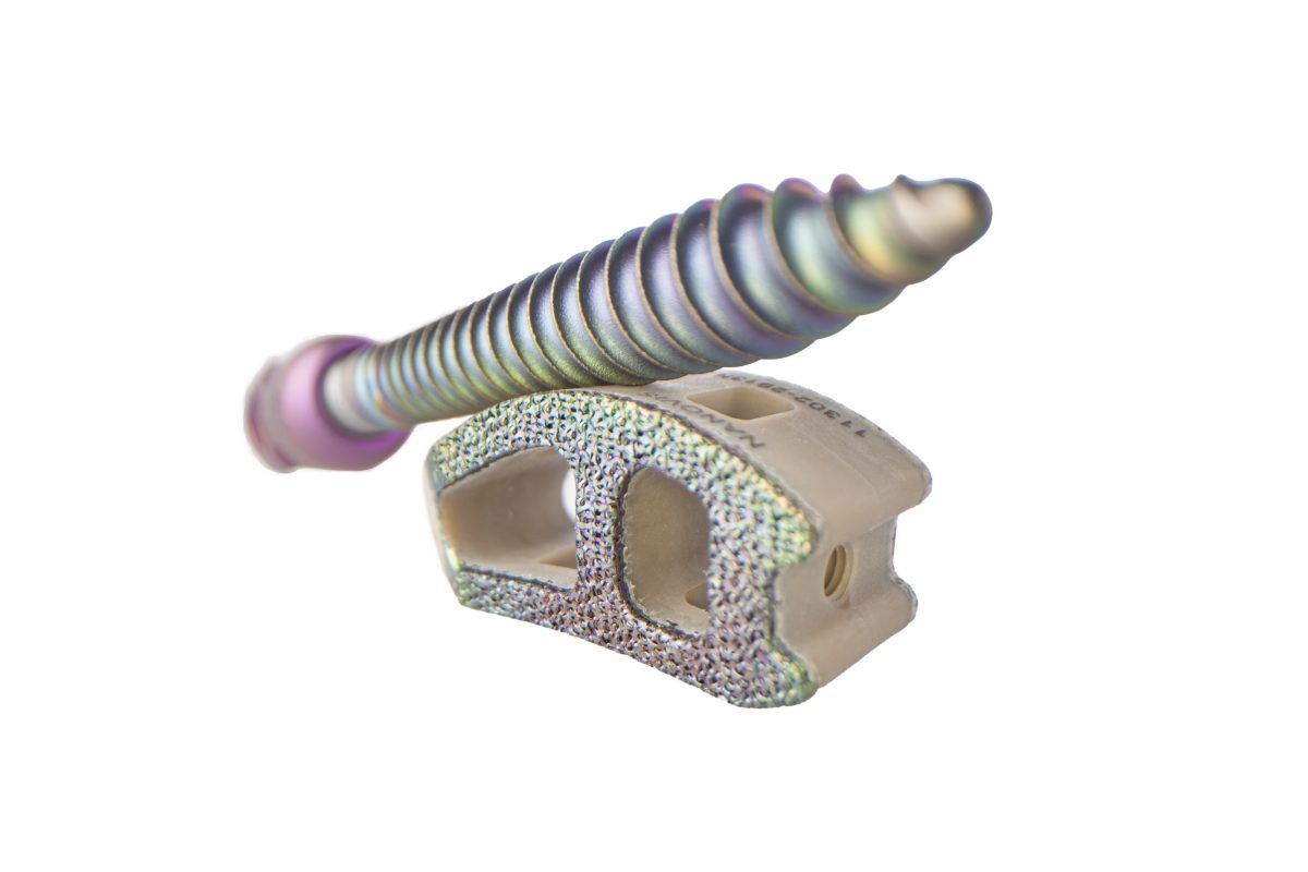 Nanovis Announces Alpha Launch of the First and Only Bioceramic Nanotube-Enhanced Pedicle Screw System, Nano FortiFix®