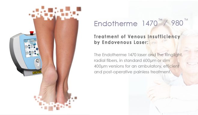 Next-Gen LUMESEAL Laser for Treatment of Varicose Vein Receives CE Approval