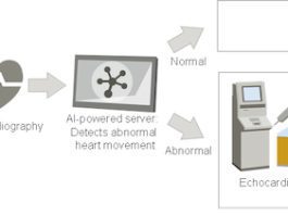 Fujitsu and University of Tokyo Hospital Embark on Joint Research into AI to Aid the Fight Against Heart Disease