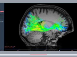 Advantis Medical Imaging Receives FDA Clearance for Brain MRI Analysis Software