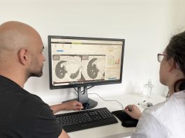 News GE Healthcare and Optellum Join Forces to Advance Lung Cancer Diagnosis with Artificial Intelligence