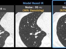 News ClariPi to Showcase its AI Medical Imaging Solutions at RSNA 2021