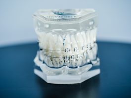 News LightForce Orthodontics Secures $50 Million Series C Funding Led By Kleiner Perkins