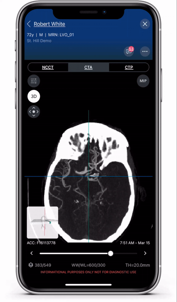 News Viz.ai Launches 2 New AI-Powered Modules for Pulmonary Embolism and Aortic Disease at the 48th Annual VEITHsymposium