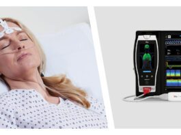 xNew Study Suggests That Masimo SedLine® Brain Function Monitoring May Aid Early Identification of Patients at Risk of Developing Postoperative Delirium