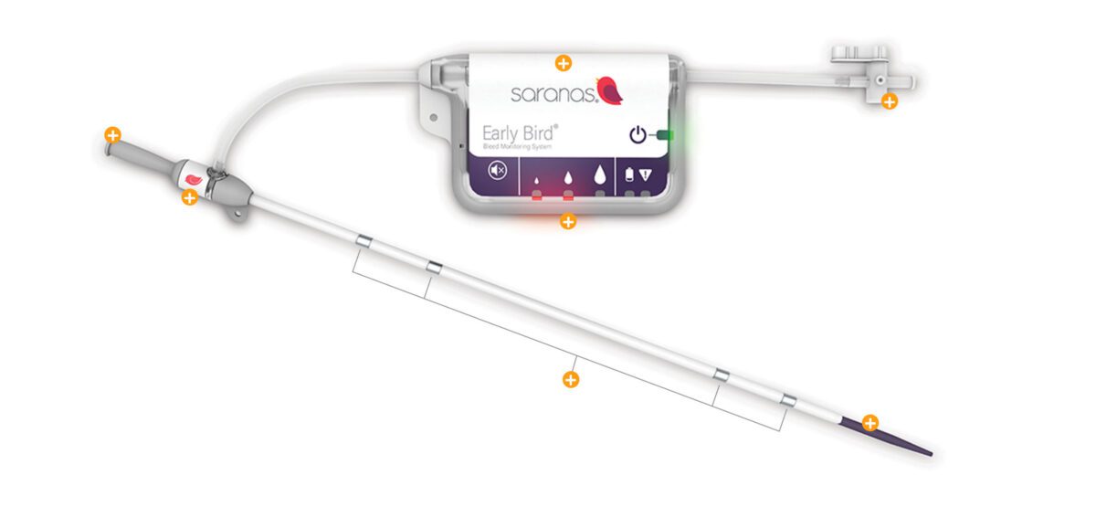 Saranas - Expands Intellectual Property with Key Patent Integrating Bleed Monitoring and Vascular Access Closure Device