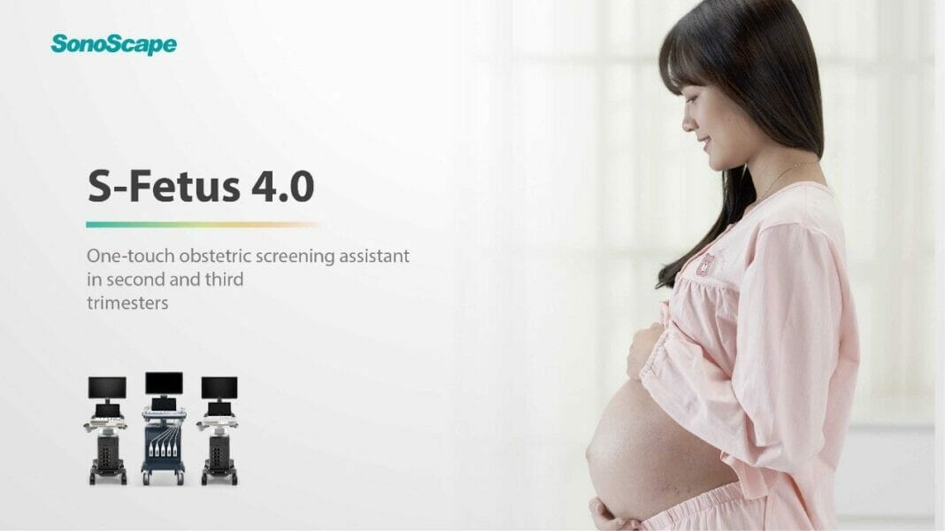 SonoScape Medical S-Fetus 4.0 Release to Simplify Sonography Process