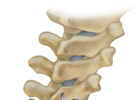 News Medtronic Receives Spine Industry’s First and Only FDA Clearance for Breakthrough Device Indicated for Ligament Augmentation