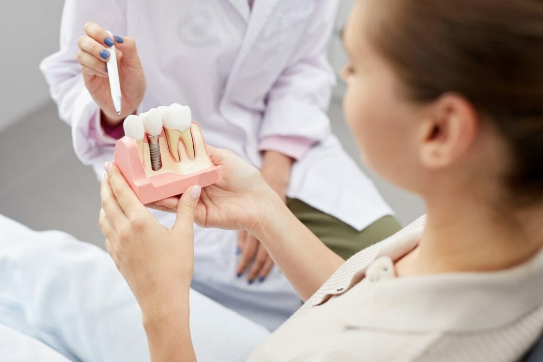 Dental Implants Pros and Cons