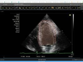 Dyad Medical Libby Echo Prio provides physicians an expanded view for image analysis