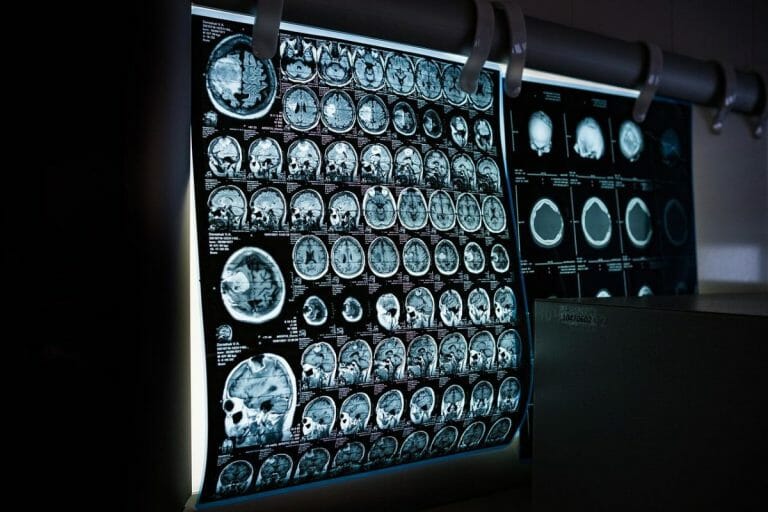What is the Distinction Between a CT Scan and an MRI Scan?