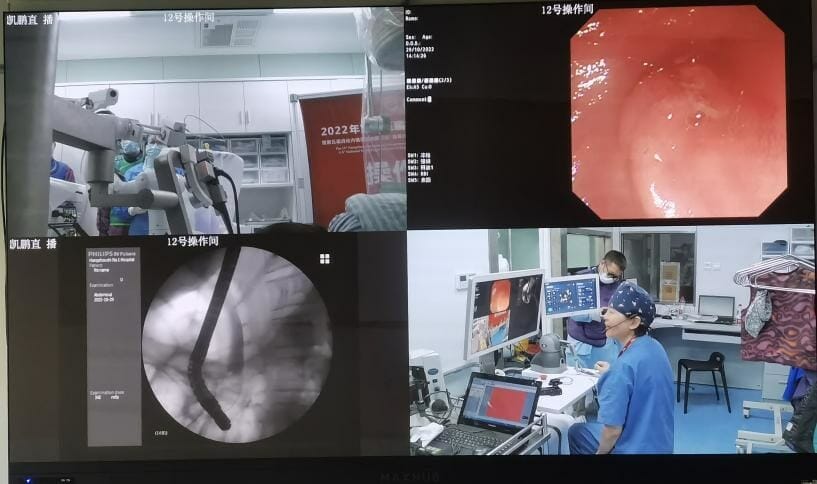 Shanghai Operation Robot announced the first Robot-assisted human clinical trial of biliary stent placement surgery