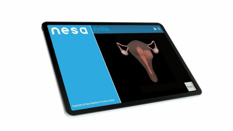 Nesa Medtech Receives FDA Clearance for Its Fibroid Mapping Reviewer Application