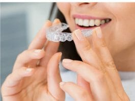 Invisalign in San Diego