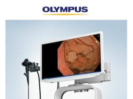 EVIS X1 Endoscopy System