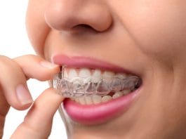 Alternatives to Traditional Braces