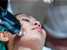 Radio Frequency Microneedling