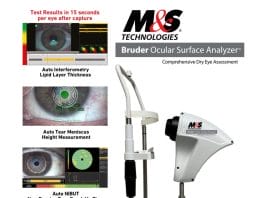 M&S Bruder Ocular Surface Analyzer