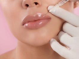 Lip Fillers