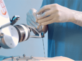 Minimally Invasive Surgical Robot