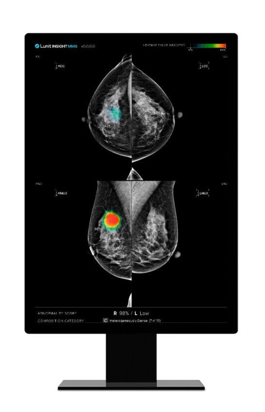 Lunit’s AI Demonstrates Up to 70% Workload Reduction and Enhanced Accuracy in Breast Cancer Screening | Study in European Radiology Reveals